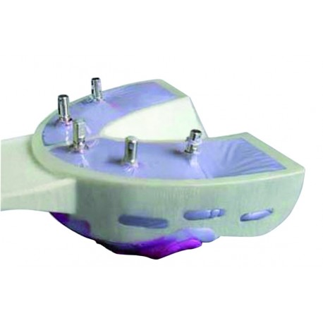 Miratray® implant