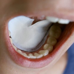 DRYDENT SOUS-LINGUAL