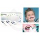 Optragate junior reassort