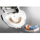 Flexistone Plus