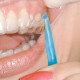 Instrument retrait aligners