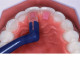TKO COMPOSITE GEL PHOTOPOLYMÉRISABLE
