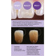 Filtek Easy Match Capsules